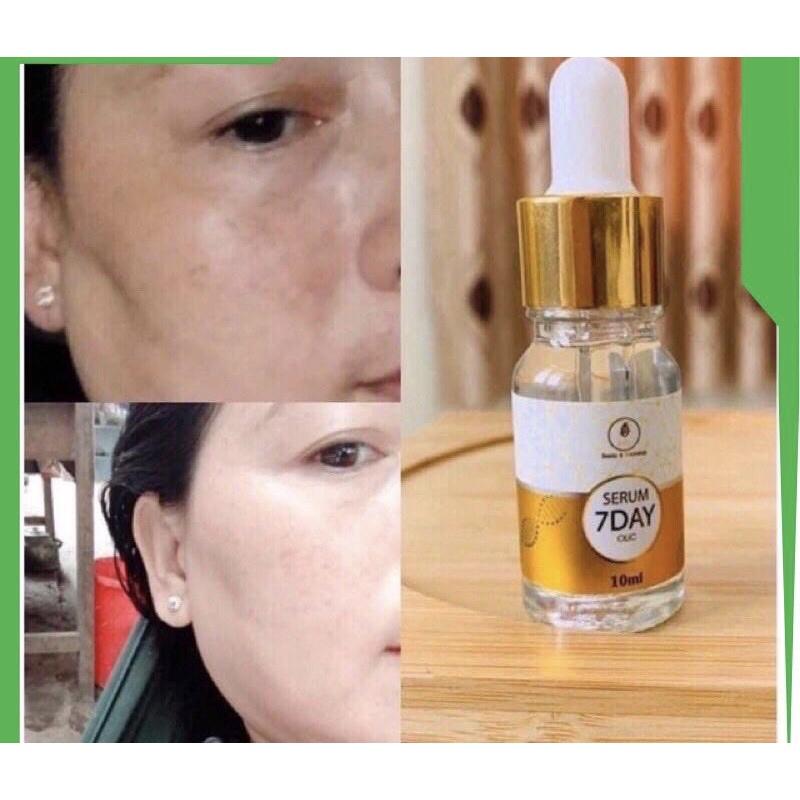 Serum 7 Day Olic Vàng 10ml Serum Huyết Thanh Truyền Trắng Xoá Nhắn, Trẻ Hoá Da