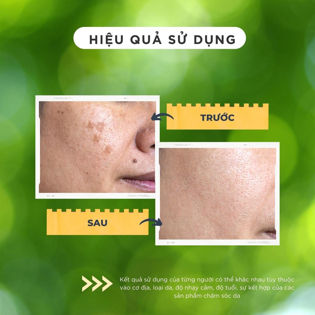 Kem dưỡng trắng, giảm mờ nám tàn nhang, mang đến làn da tươi sáng, căng bóng Chamis