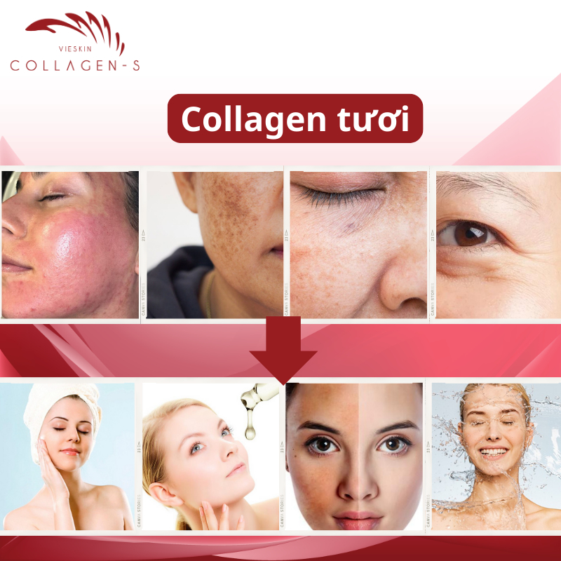 Tinh chất collagen tươi Vieskin Collagen Gold Shine căng bóng da, làm đẹp, trẻ hoá da và chăm sóc môi sau phun xăm 7ml