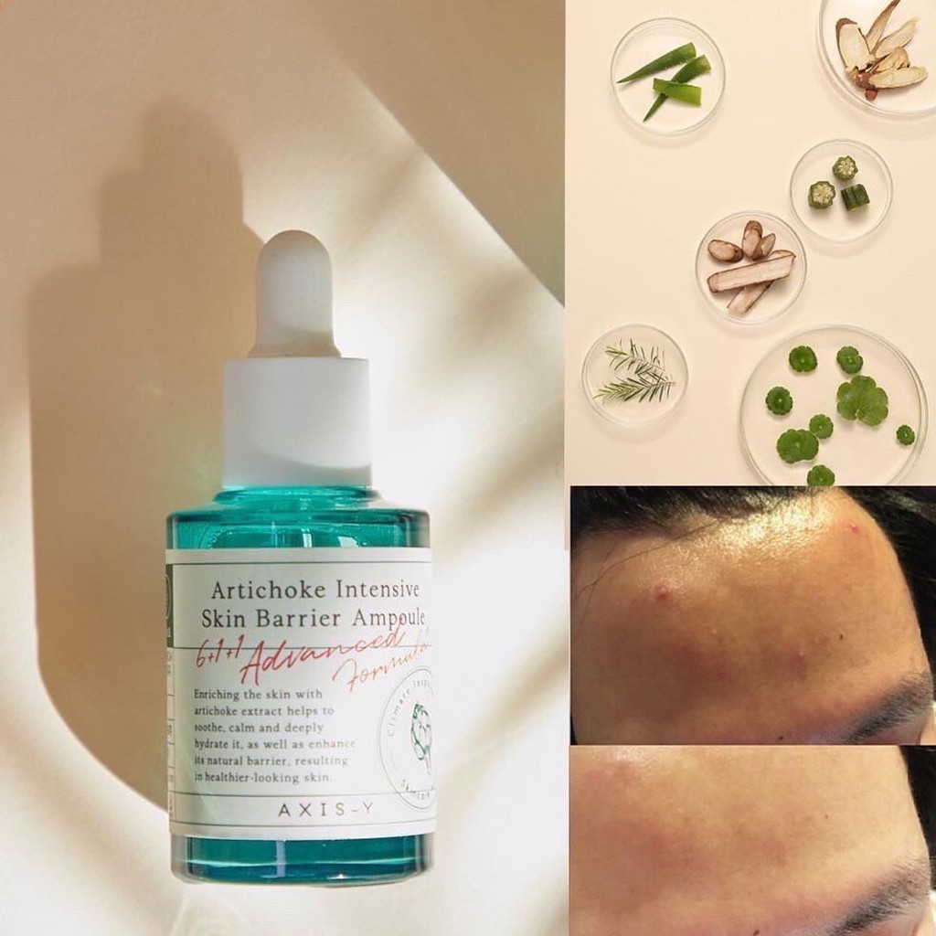 Serum dưỡng ẩm và phục hồi da AXIS-Y Artichoke Intensive Skin Barrier Ampoule 30ml