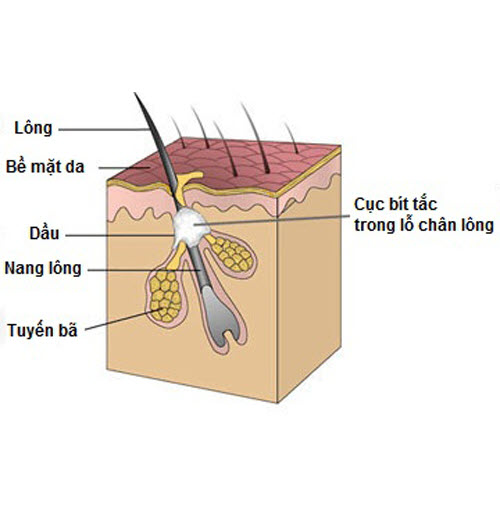 Thảo dược bôi nấm ngứa, tổ đỉa, hắc lào, lang ben, vảy nến, á sừng, zona các vấn đề về da_1 hộp 20 gói