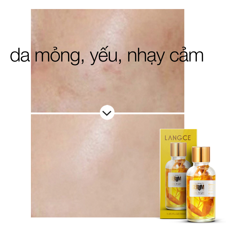 SERUM SÂM GIẢM MẪN ĐỎ, CHỐNG VIÊM TĂNG CƯỜNG KHẢ NĂNG MIỄN DỊCH CHO DA 30ml LANGCE dành cho Nam