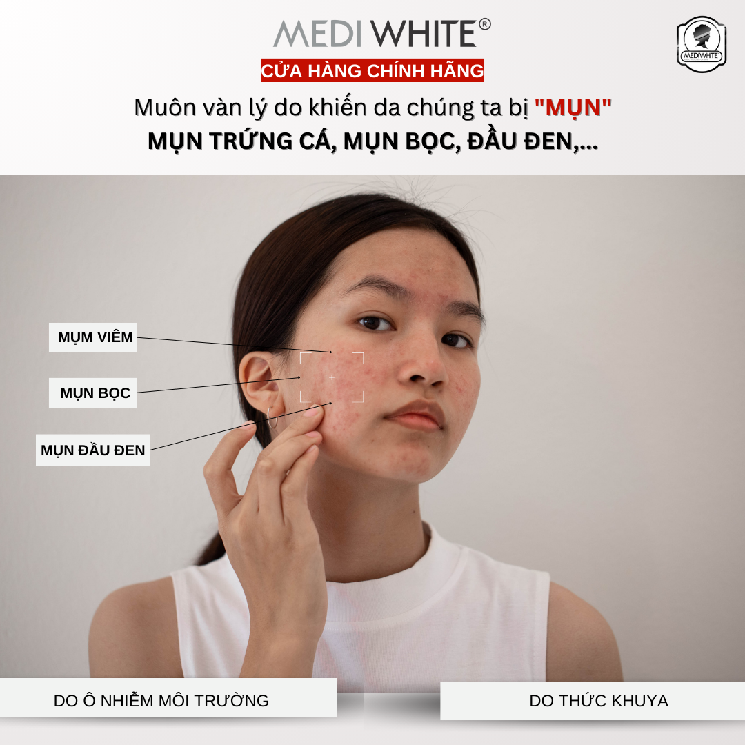 Kem Chấm Mụn Medi White Giúp Loại Bỏ Cồi Mụn Giảm Thâm Mụn Hiệu Quả