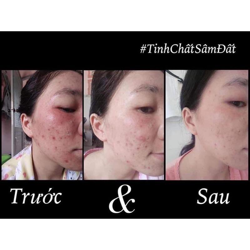 Tinh Chất Sâm Đất DR CELL 50ml