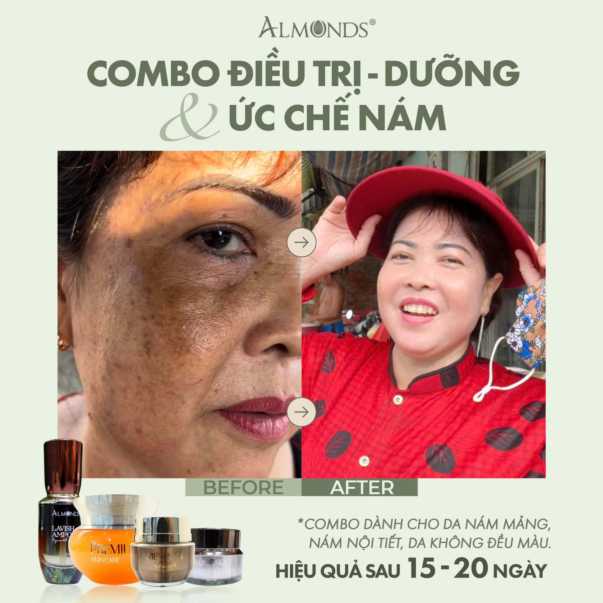 Kem Tái Tạo đánh bay Nám Almonds Melasma Cream 20g