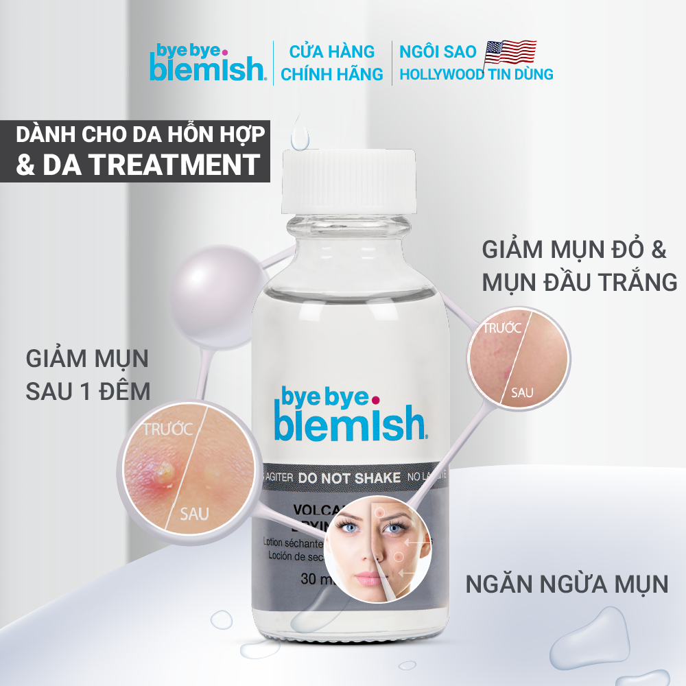 Chấm Mụn Tro Núi Lửa Giảm Mụn Nhanh Sau 1 Đêm Dành Cho Mụn Trắng, Sưng Đỏ Bye Bye Blemish Volcanic Ash Drying Lot