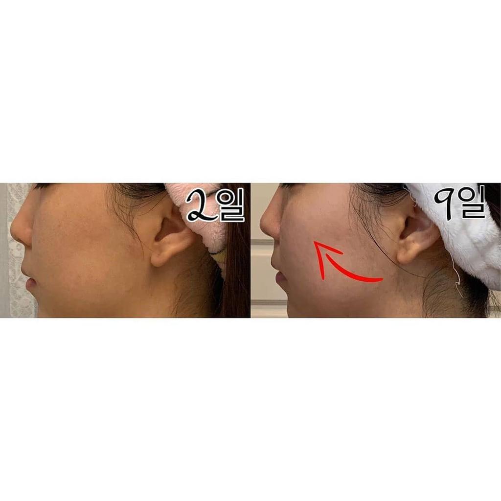 Bộ mặt nạ ampoule nâng cơ, làm sáng và chống lão hoá Dr.NDS Vlifting & Brightening mask