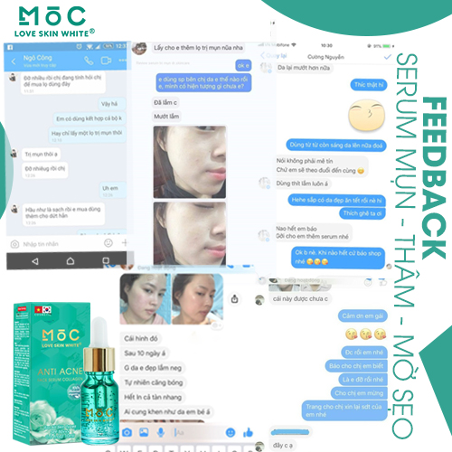 Serum Ngừa Mụn Thâm, Mờ Sẹo 10ml MỘC