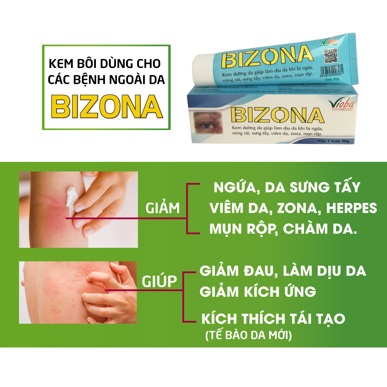 Bộ đôi kết hợp uống và bôi ngoài da: Bizona và kem Bizona - Giải độc dị ứng, giảm mẩn ngứa ngoài da, sẩn mề đay, rôm sảy. Giảm đau bụng, tiêu chảy, buồn nôn do dị ứng thức ăn. Sản phẩm của Vioba, hộp 60 viên &amp; tuýp 30g