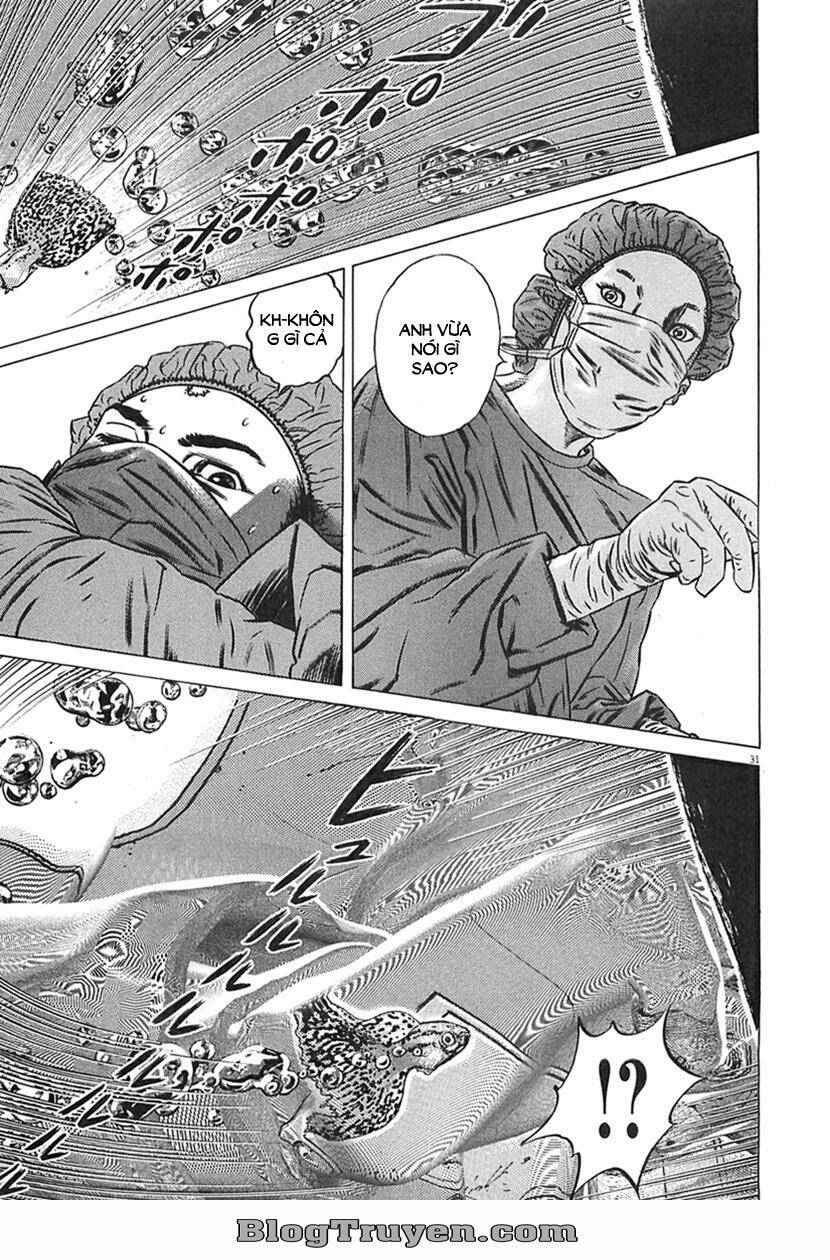 homunculus chapter 63 17