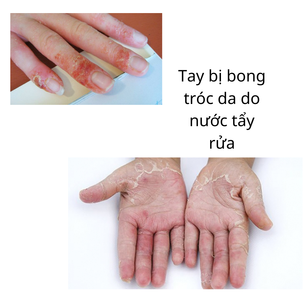 Mua 3 Tặng 2 Đôi Găng Tay cao Su Tự Nhiên Hàn Quốc Có Móc 38cm