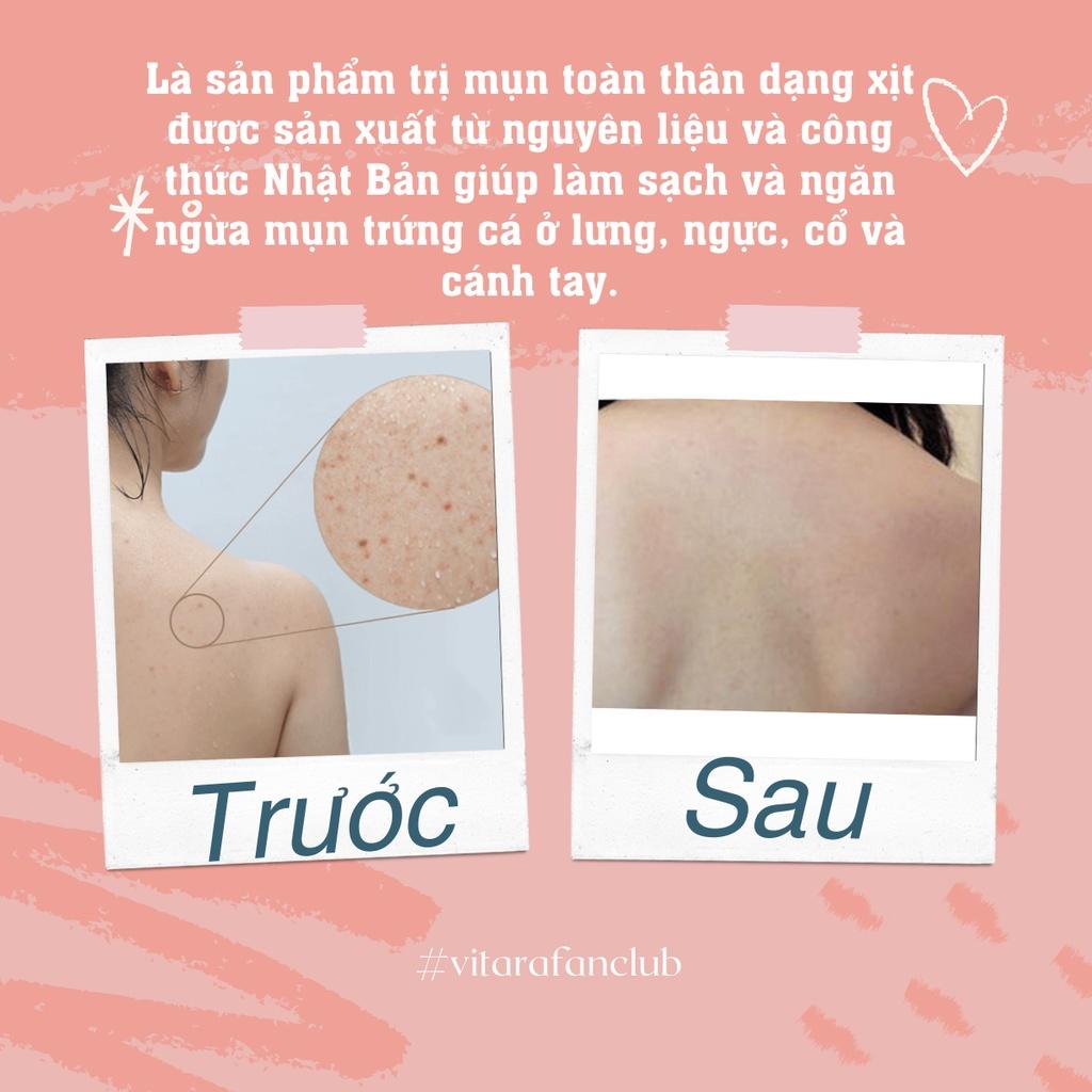 Xịt mụn toàn thân Vitara SE BODY ACNE SPRAY giảm thâm mụn, sẹo mụn 50ml