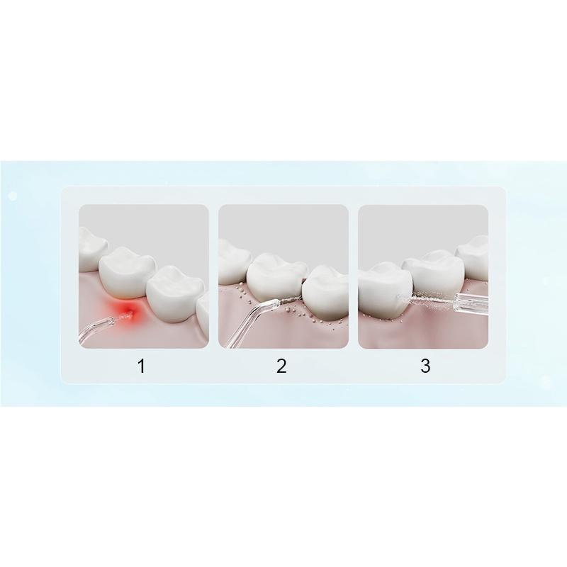 Máy Phun Nước Làm Sạch Răng Miệng Xiaomi MIJIA F300 Kích Thước Nhỏ Gọn