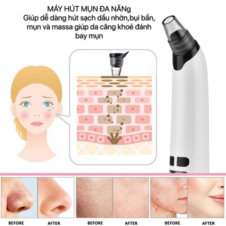 Máy Hút Mụn Electric Black Remover có đầu Massage, 5  chế độ đa năng làm sạch mụn cám, đầu đen, body. Tiện dụng gọn nhẹ.