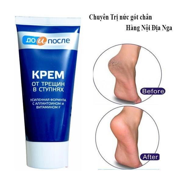 Kem giúp giảm tình trạng nứt gót chân Kpem 50ml( không xuất hóa đơn đỏ )