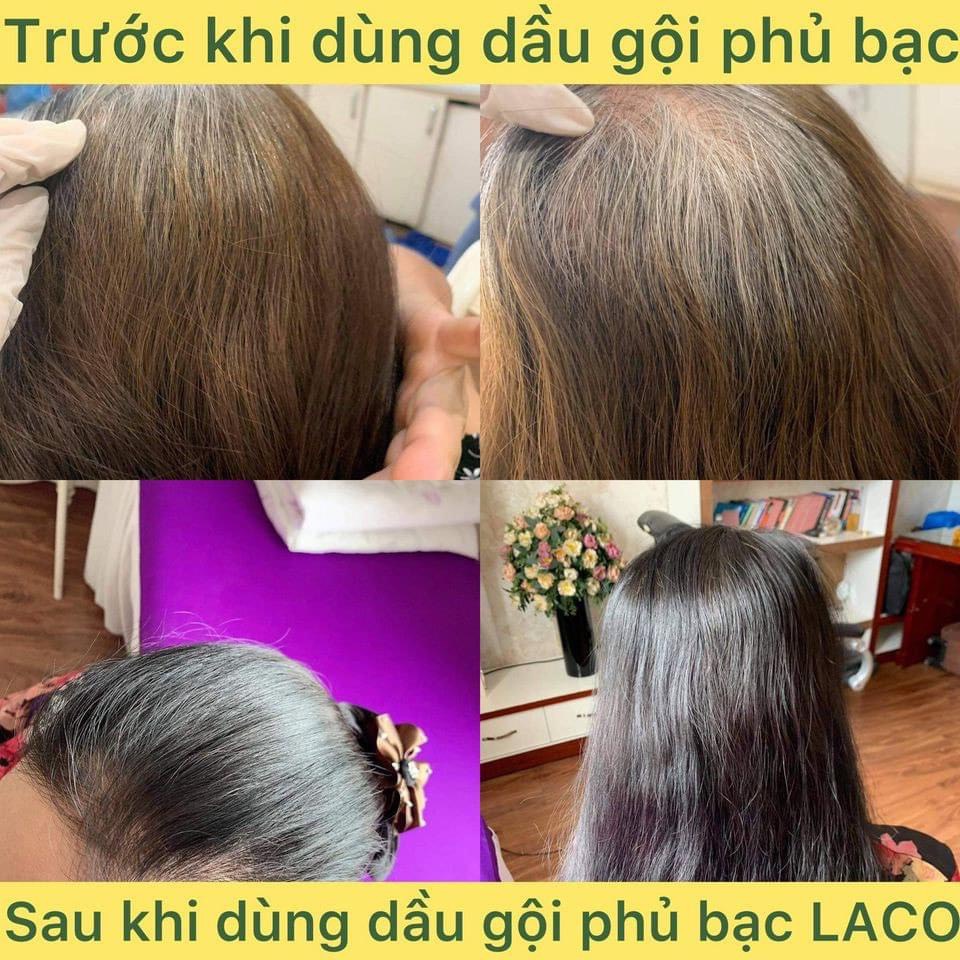 Dầu Gội Phủ Bạc Laco Black Hair 200ml giúp tóc đen tự tin sau 9 phút