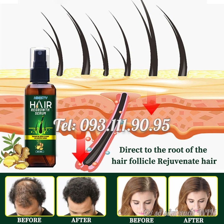Serum dưỡng mọc tóc, giúp tóc mọc nhanh, nhiều và dày, sợi tóc đen bóng xuất xứ Nhật Bản – Mã số 1230