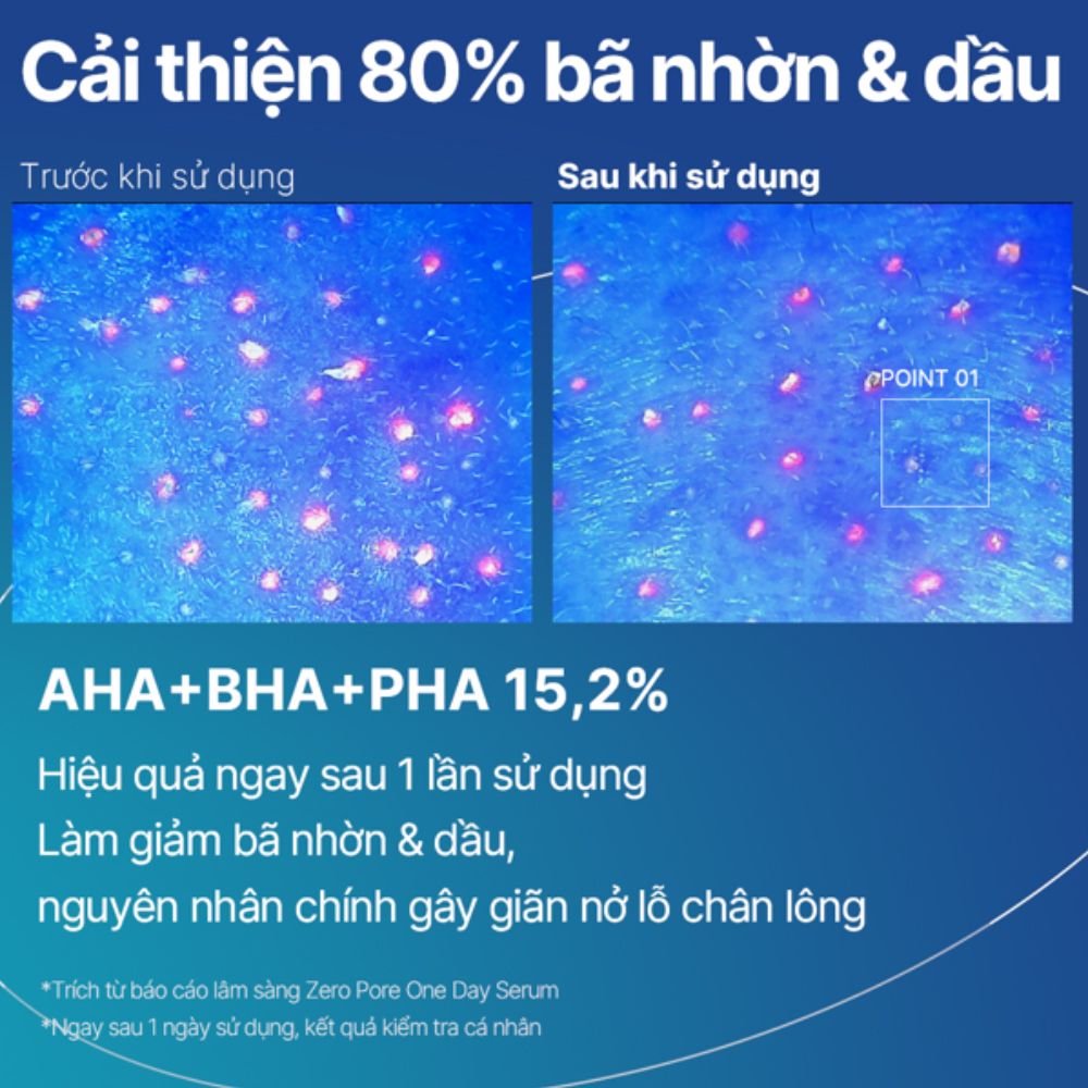 Tinh chất Thu nhỏ lỗ chân lông medicube ZERO PORE ONE DAY SERUM 30ml