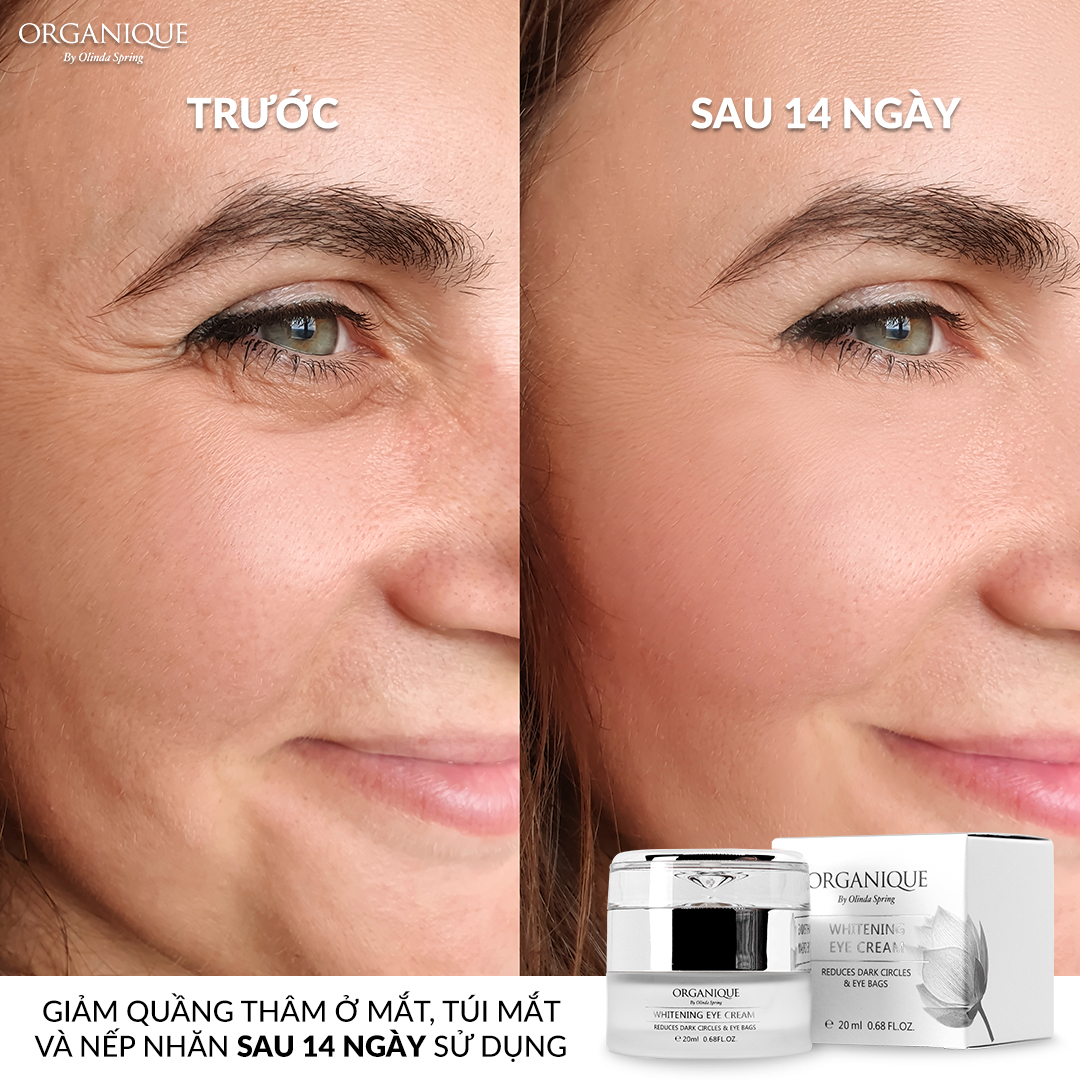 Kem mắt dưỡng trắng Whitening Eye Cream 20ml