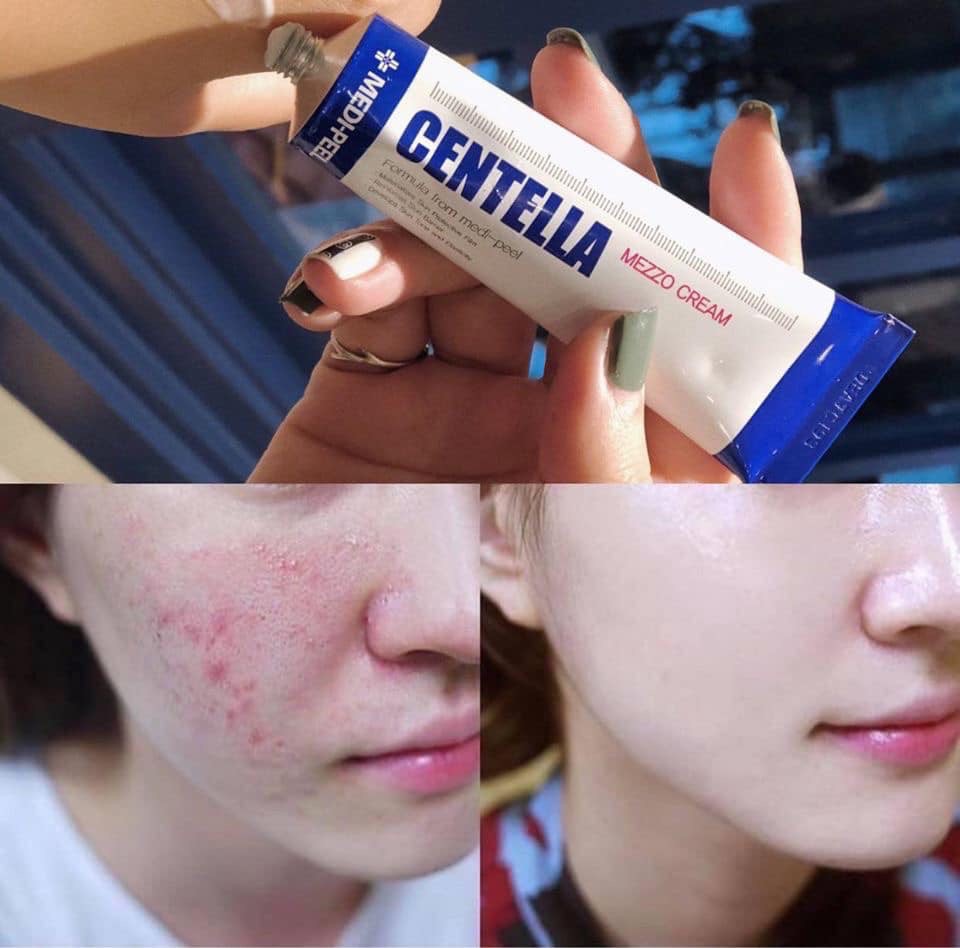 Kem Dưỡng Phục Hồi Chuyên Sâu Cho Da Mụn Medi-Peel Centella Mezzo Cream 30ml - Hàn Quốc