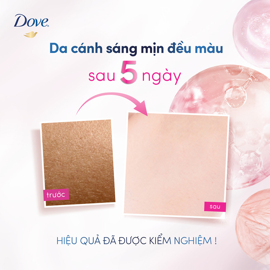 Combo 2 Kem ngăn mùi tinh chất serum vùng cánh cao cấp Dove dành cho nữ với 3% Niacinamide giúp dưỡng da sáng mịn đều màu và mờ thâm thu nhỏ lỗ chân lông 40ml