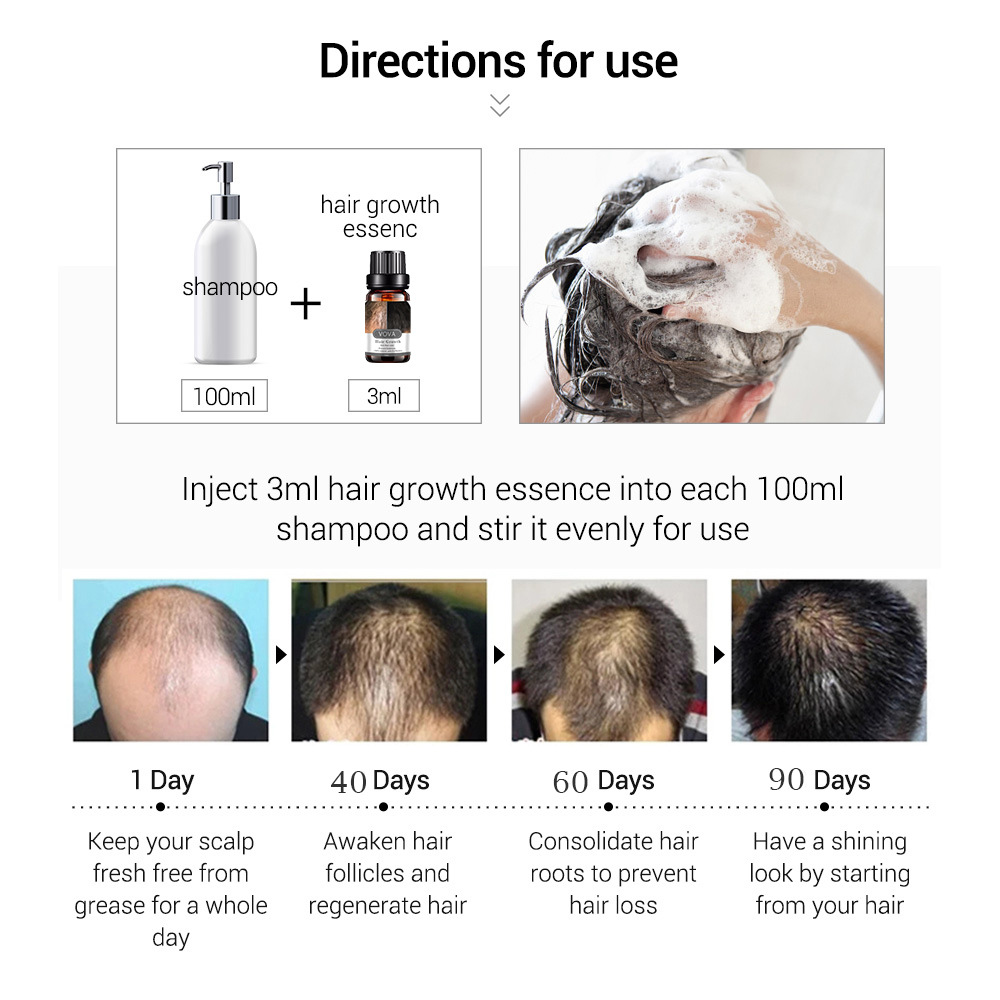 Serum mọc tóc, chống hói, chống rụng, chống gãy tóc, thành phần tự nhiên an toàn và tiện dụng