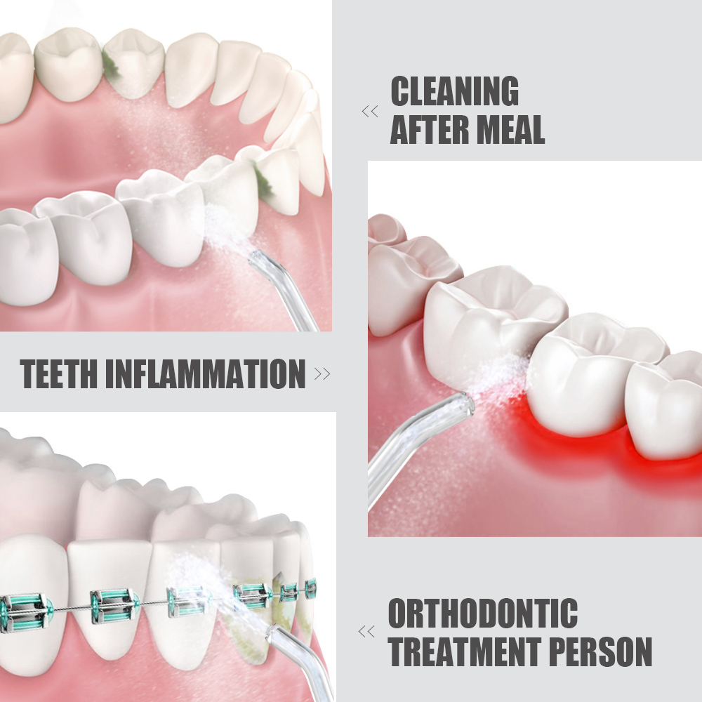 Tăm Nước Làm Sạch Răng Không Dây Youpin Zhibai Dụng Cụ Phun Kép Thiết Kế Di Động Có Thể Sạc Lại IPX7 Không Thấm Nước