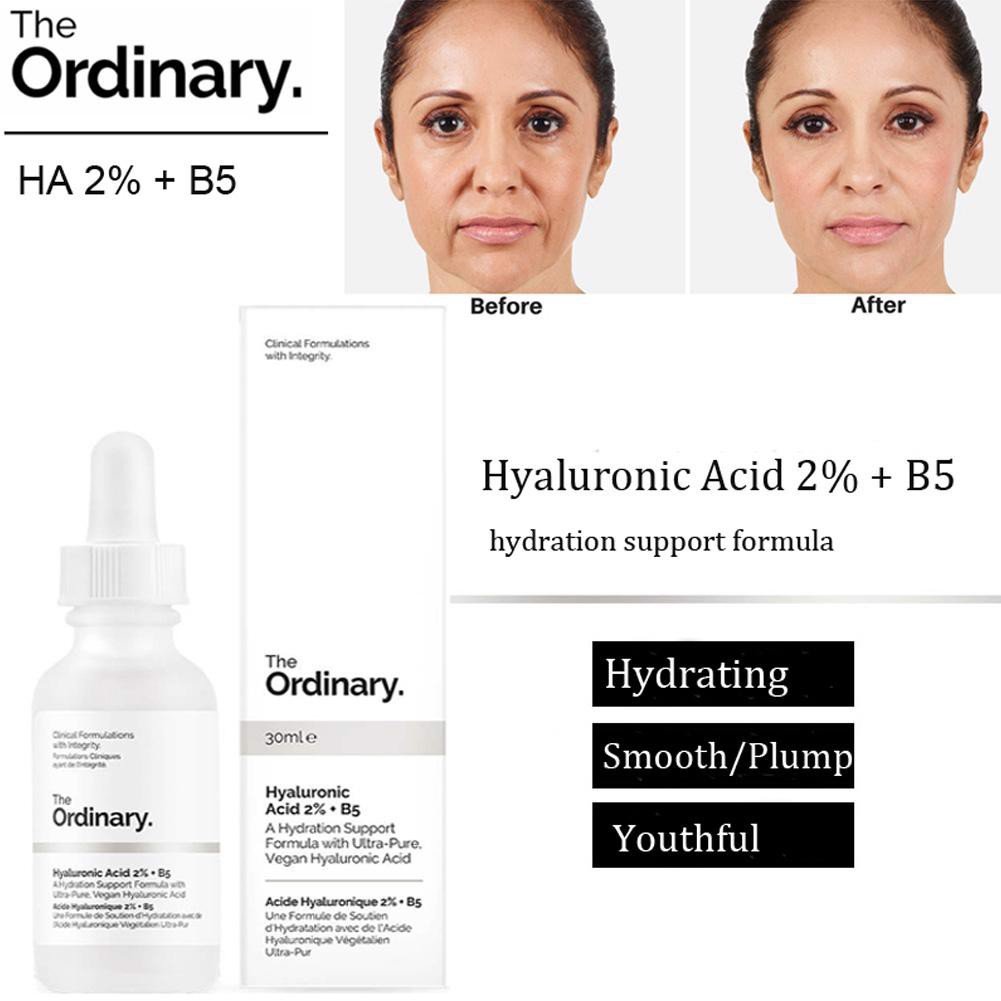 Tinh chất dưỡng the Ordinary Hyaluronic Acid 2 % + B5