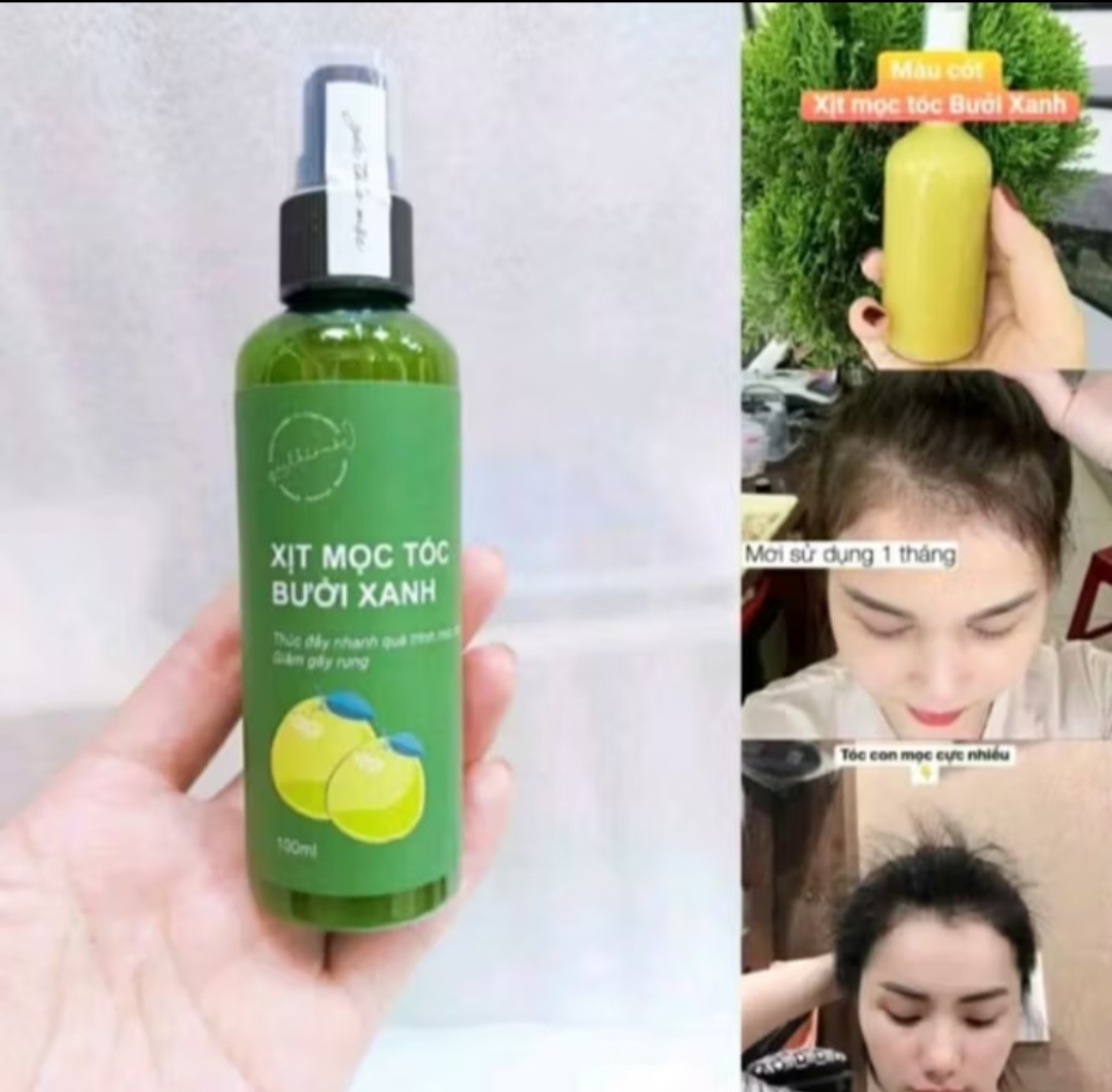 1 CHAI TINH DẦU THẢO MỘC XỊT KÍCH THÍCH MỘC TÓC CAO CẤP CHO MỌI GIA ĐÌNH