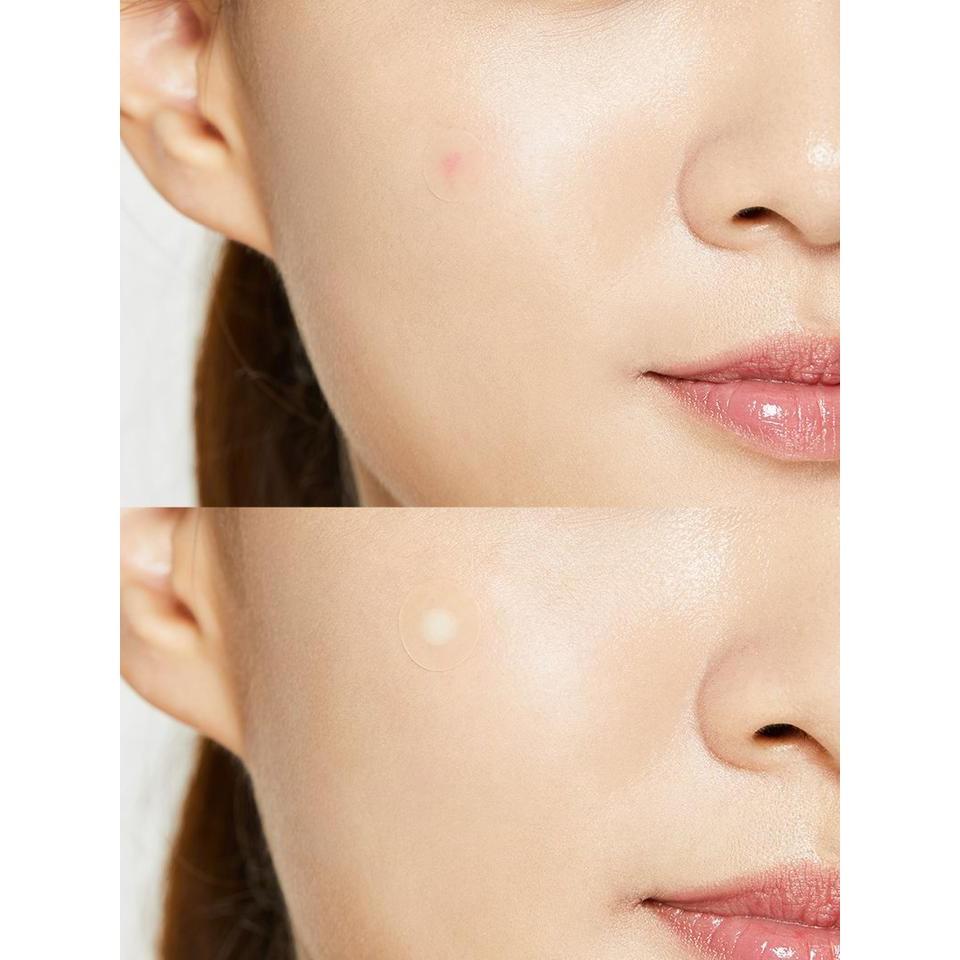 Combo Gel Rửa Mặt + Dán Mụn COSRX: Low pH Good Morning 150ml + Acne Pimple Master Patch 24 miếng