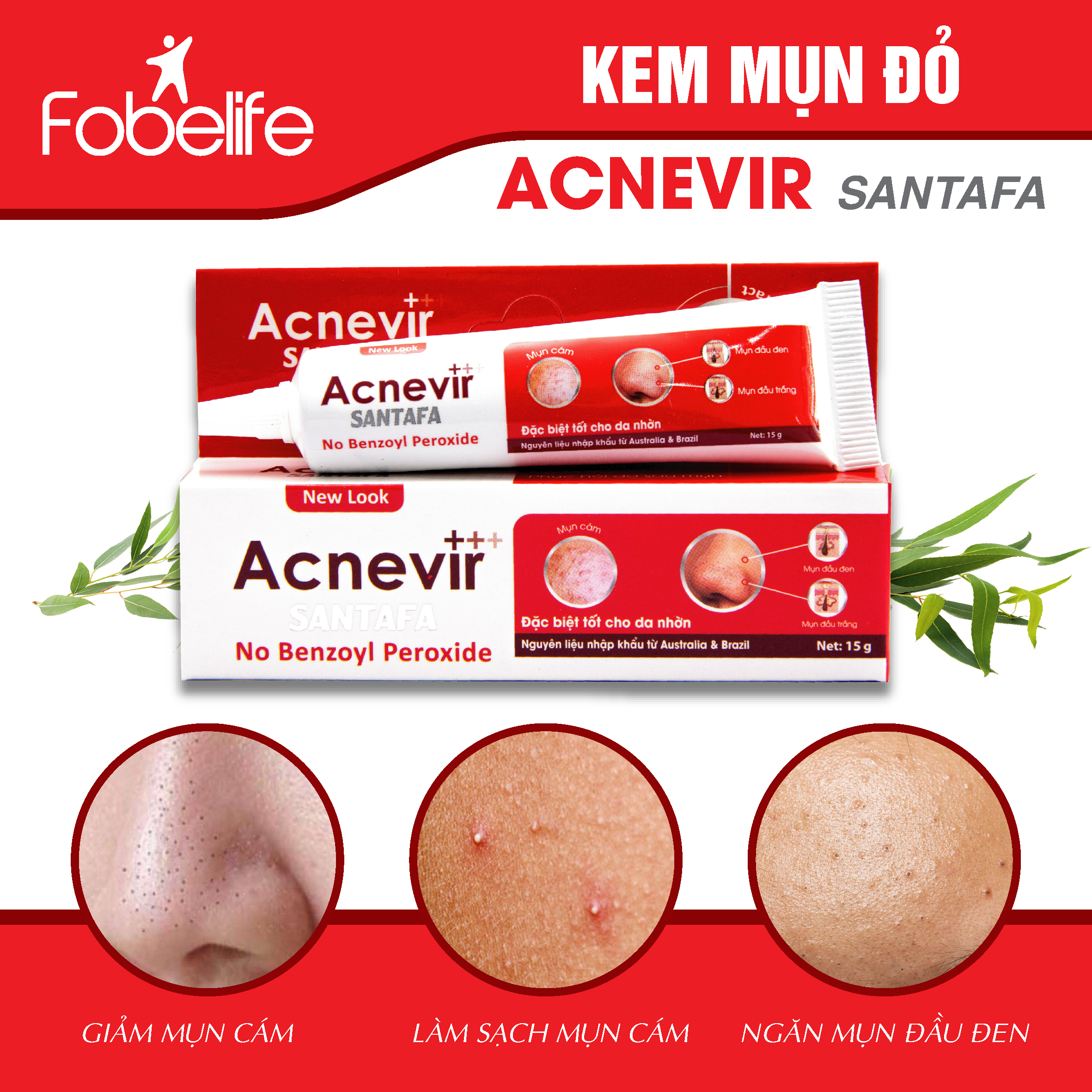 Combo 3 Kem Trị Mụn Đỏ Đầu Đen, Đầu Trắng, Mụn Cám Hiệu Quả Acnevir Santafa  Tuýp 15gr