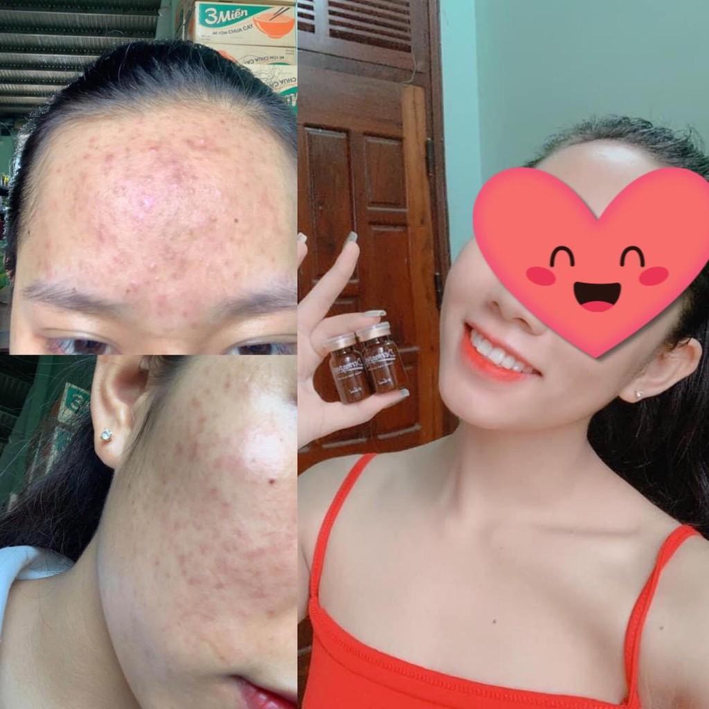 Vi kim tảo biển trứng cá tuyết Derma peel+ Skincare Total Solution - Vì Làn Da Hoàn Hảo