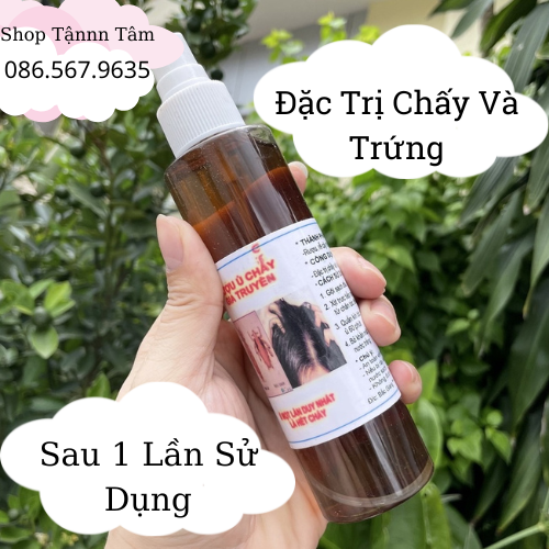 Dầu Gội Hết Chấy Chí. Ủ Chấy Cho Bé.  Dùng 1 Lần Là Hết. Số lượng 1 chai 150ml.