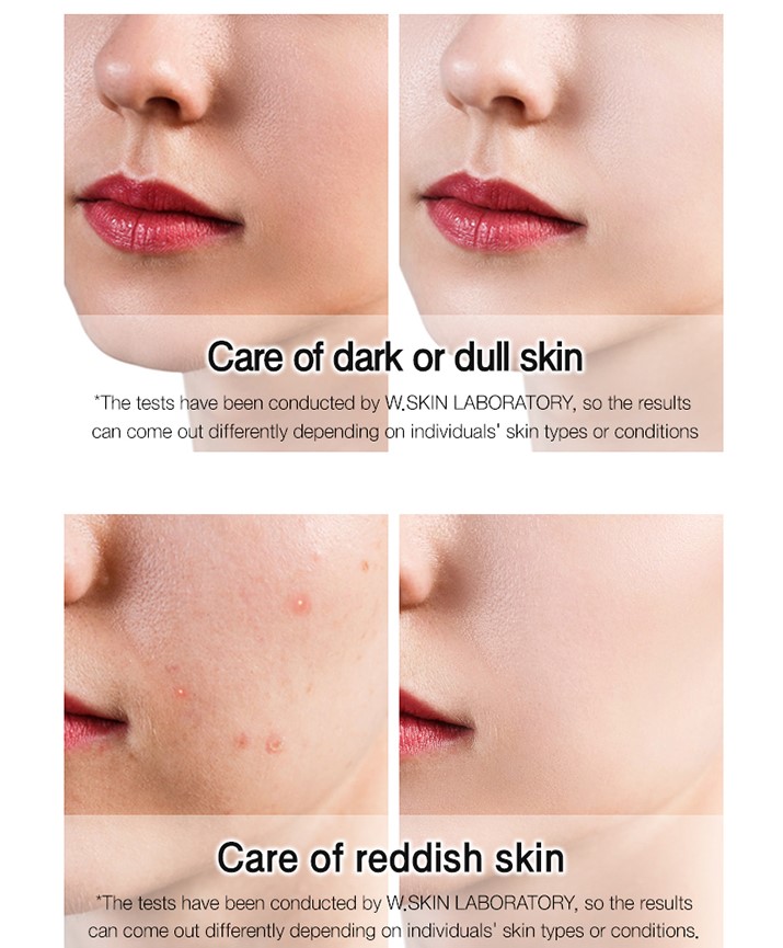 Kem dưỡng trắng và nâng tông da WHITE GLUTATHIONE TONE UP CREAM