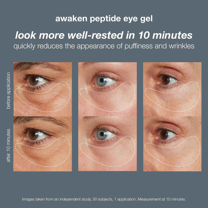 Dưỡng mắt Dermalogica Awaken Peptide Eye Gel 15ml