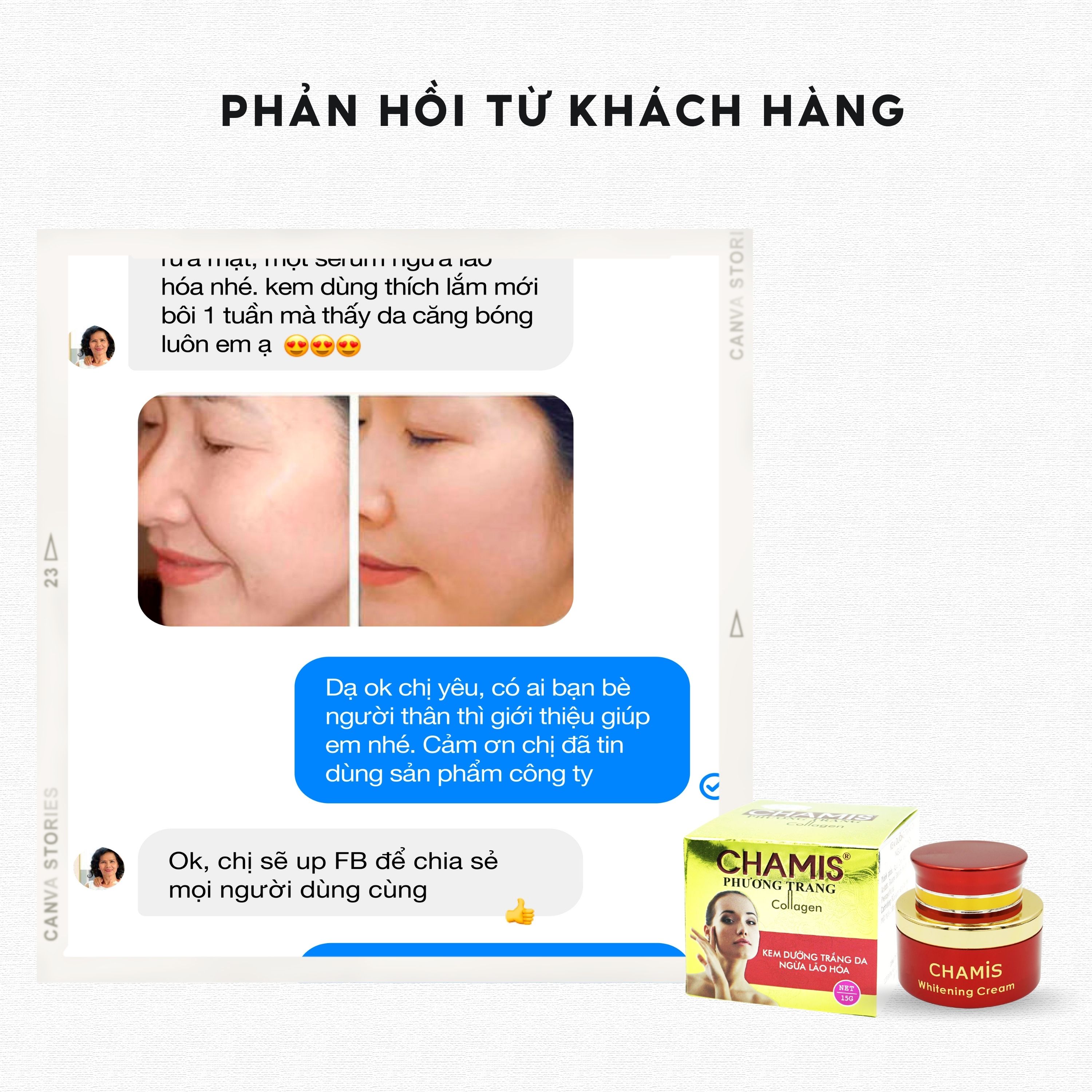 Kem dưỡng trắng ngừa lão hóa da CHAMIS