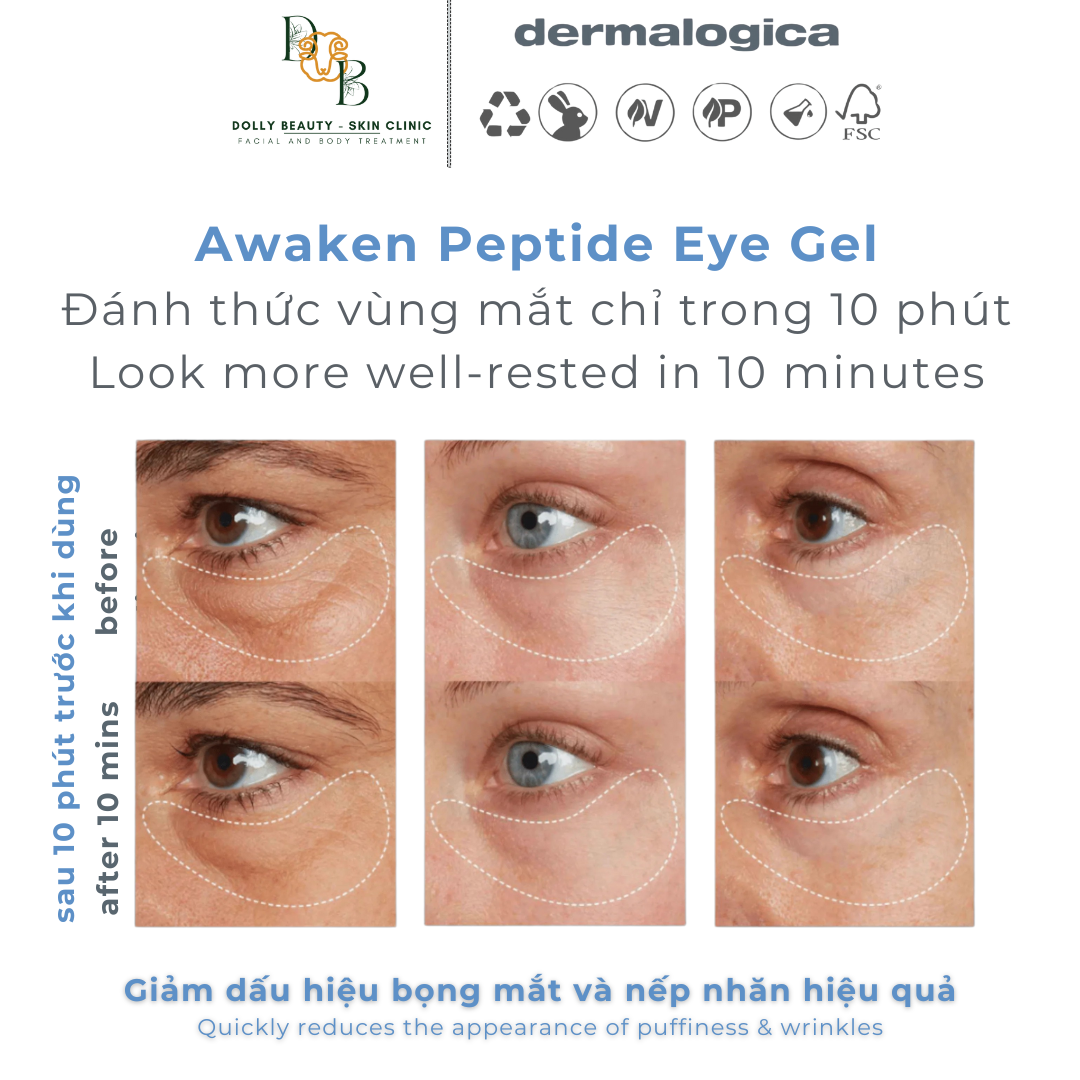 [DERMALOGICA] Kem dưỡng mắt dạng gel giúp mắt khoẻ AWAKEN PEPTIDE EYE GEL đánh thức vùng mắt từ sâu bên trong
