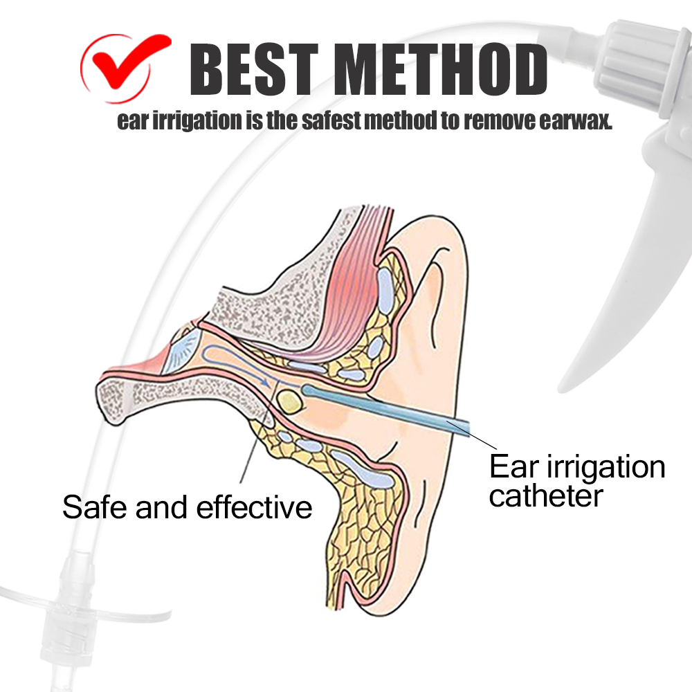 Bộ dụng cụ vệ sinh tai tại nhà