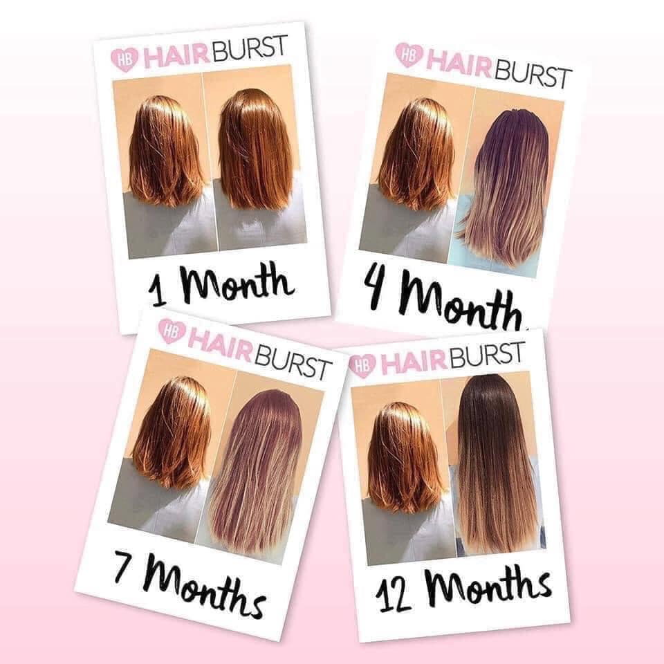 Set Gội Xả Kích Thích Mọc Tóc Hairburst For Longer Stronger Hair (Dầu Gội 350ml + Dầu Xả 350ml)