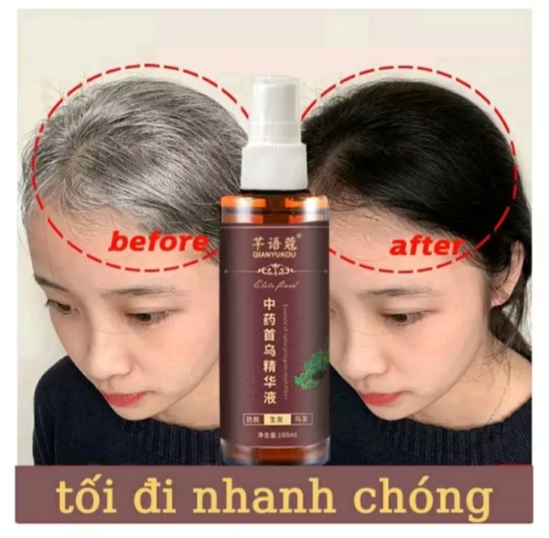 CHAI TINH DẦU THẢO MỘC XỊT ĐEN TÓC TÓC TRẮNG THÀNH TÓC ĐEN DƯỠNG TÓC CAO CẤP