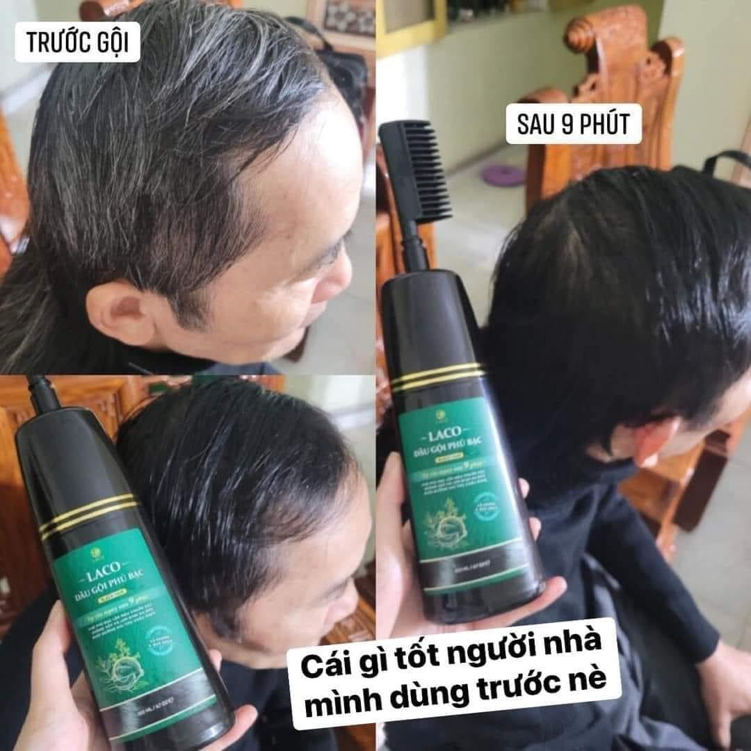 Dầu Gội Phủ Bạc Laco Black Hair - Tóc Đen Tự Tin Sau 9 Phút không phai không sót không hại da đầu mùi thơm chinh hãng sale