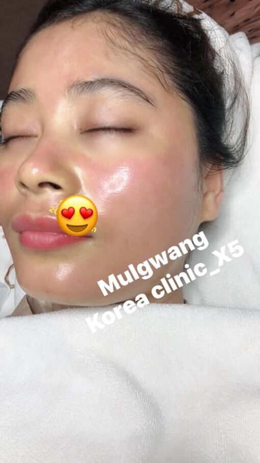 Tinh chất siêu căng bóng mulgwang X5 hàn quốc, Căng bóng Mulwang x5 thế hệ mới giúp Làn da của bạn sẽ trẻ thêm tuổi chỉ sau một lần sử dụng liệu trình