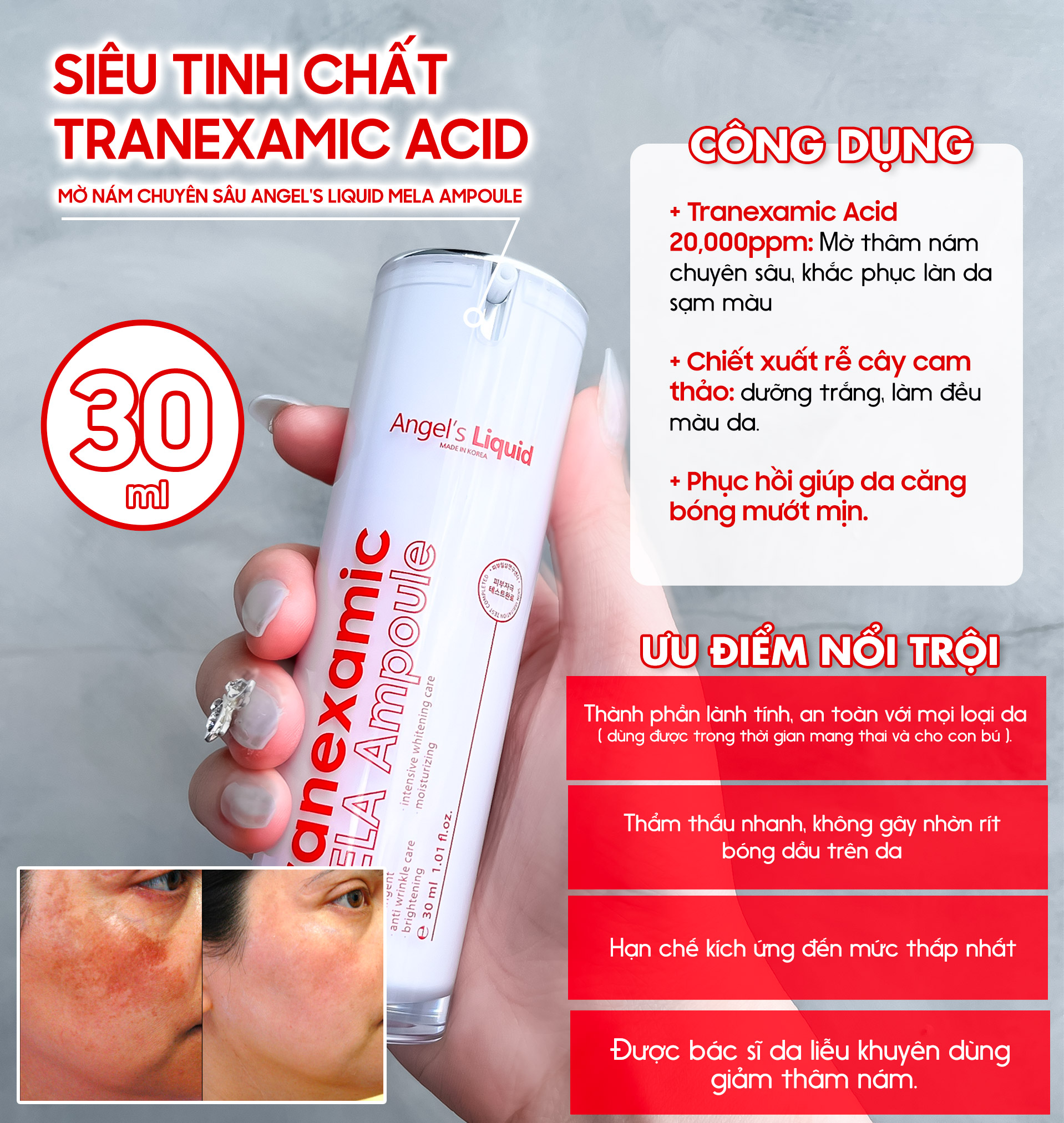 Siêu Tinh Chất Tranexamic Acid Mờ Nám Chuyên Sâu Angel's Liquid Mela Ampoule 30ml