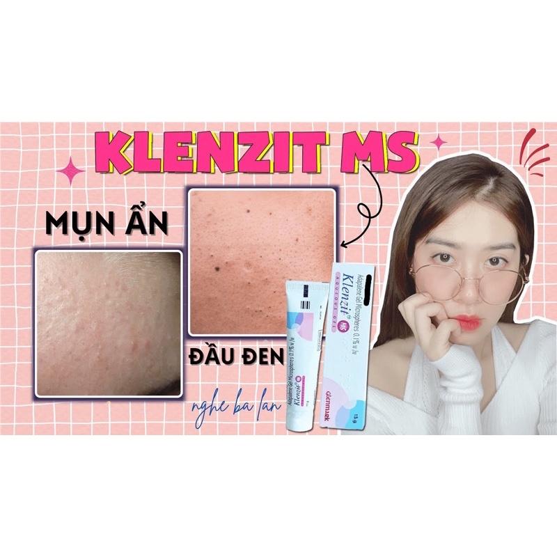 MS &amp; C GEL - GIẢI PHÁP CHO MỤN ẨN, MỤN TRỨNG CÁ CÁC LOẠI(HÀNG CÔNG TY KÈM HOÁ ĐƠN