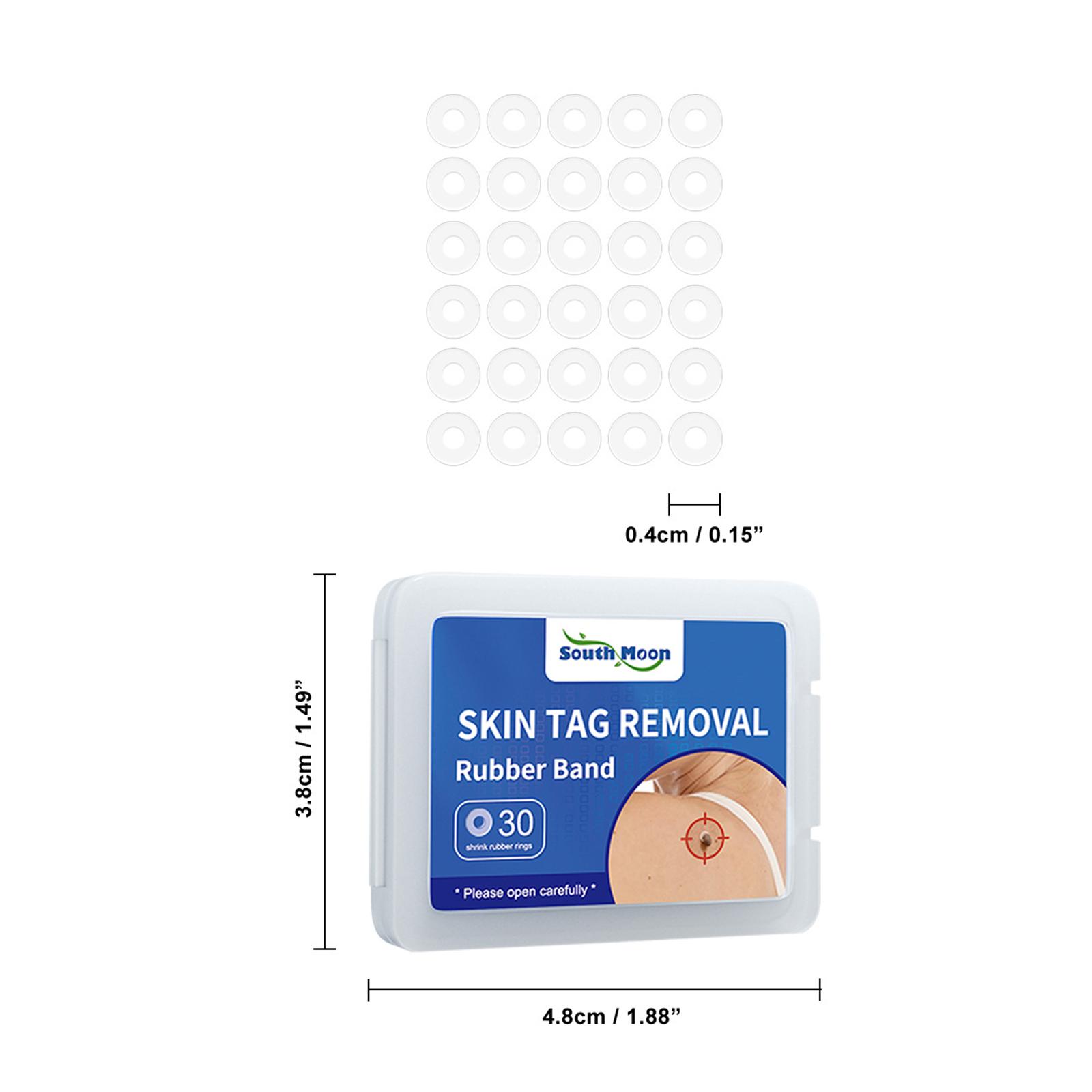 South Moon 30pcs/Box Mole Wart Remover Skin Tag Rubber Band Soften Keratin Painless Removal