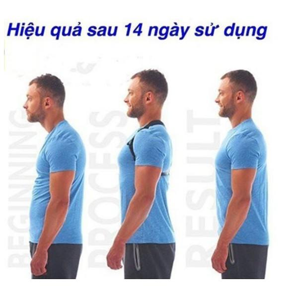 Đai Chống Gù Lưng, Đai Định Hình Cơ Thể Chống Gù Lưng  Nam,Nữ ENERGIZING POSTURE SUPPORT