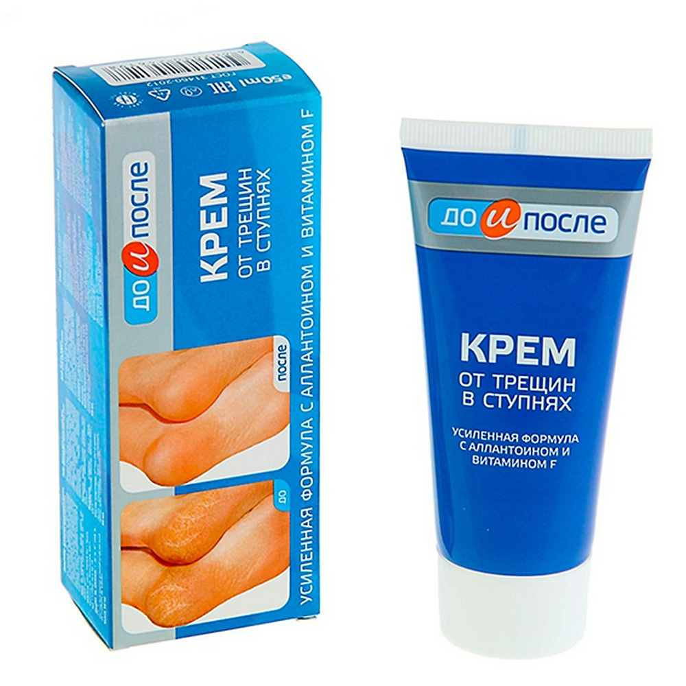 Kem Ngừa Nứt Gót Chân KPEM Dưỡng Ẩm và Làm Mềm 50ml NGA. Tặng Gel Móc Khóa 30ml