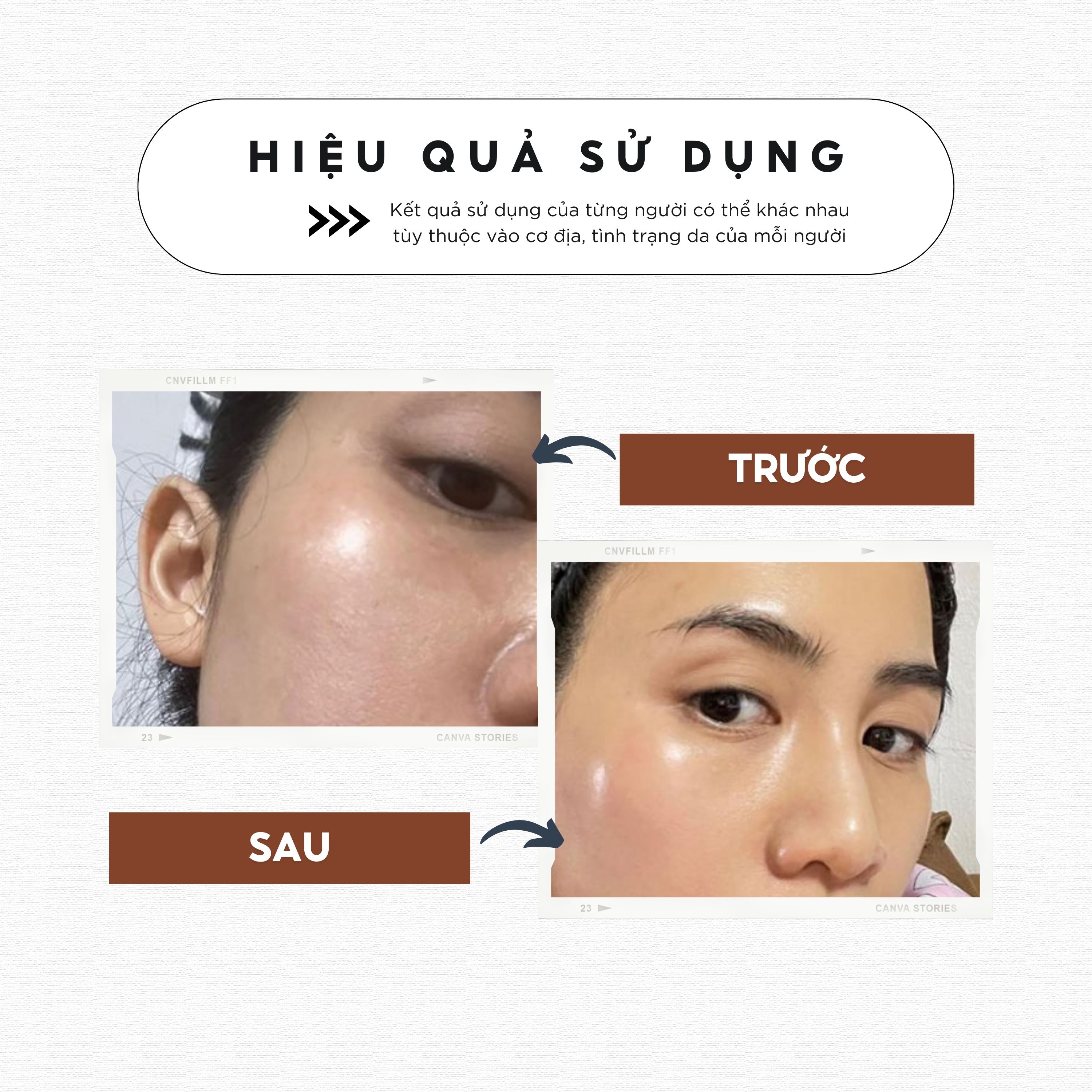 Kem dưỡng trắng, tăng sinh collagen tái tạo làn da săn chắc, sáng mịn Chamis