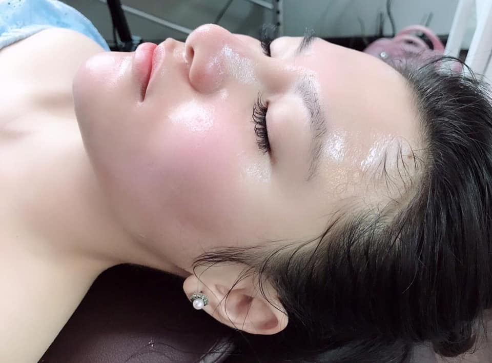Serum Căng Bóng Da Tinh Chất Cá Hồi MULBERRY - 3 Ngày Dưỡng Trắng Mịn Màng, Thu Nhỏ Lỗ Chân Lông - Sản Phẩm Thay Thế Bortox - Tâm Sinh An Cosmetic