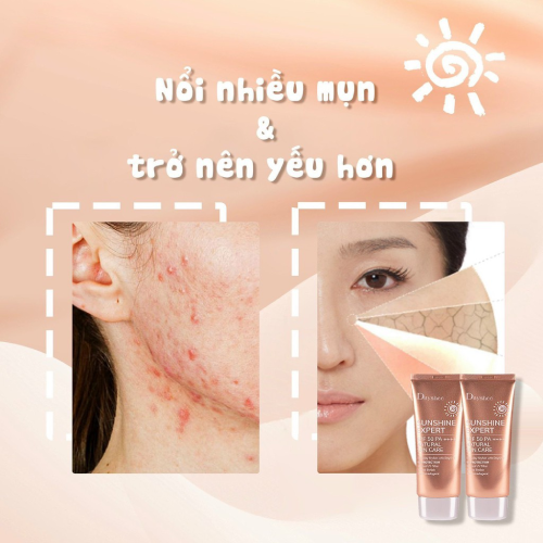 Kem chống nắng tối ưu Đa bảo vệ 96,9% Chiết xuất tự nhiên 100% - SUNSHINE EXPERT